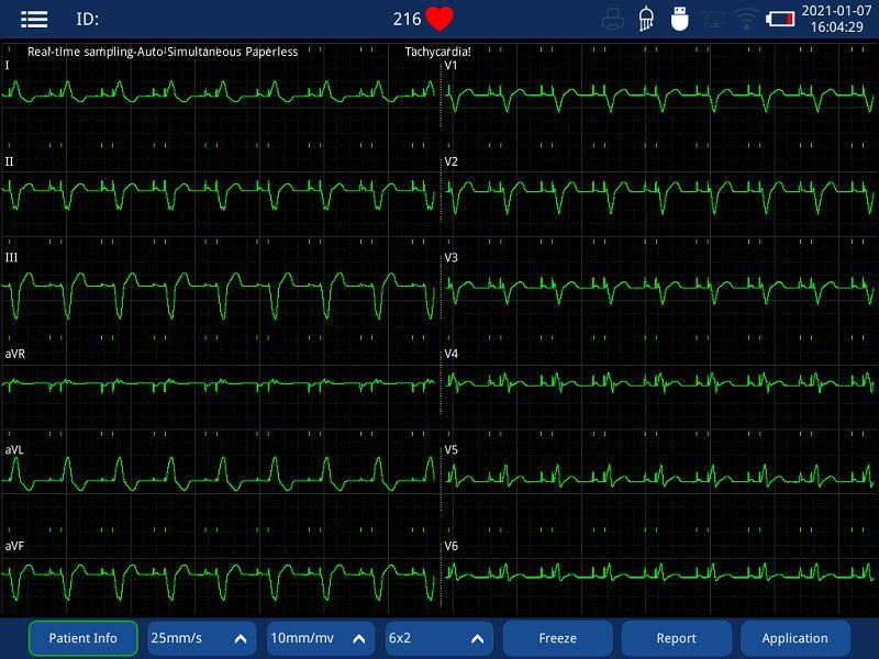12 channel electrocardiograph machine with printer(001) 12 channel electrocardiograph machine with printer(001)